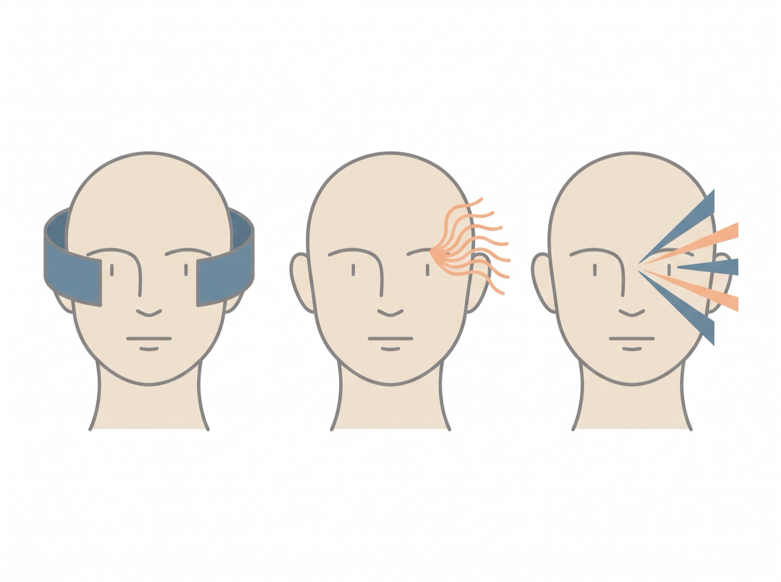 締めつけられる痛み・脈打つ痛み・目の奥の激しい痛みを並べた図